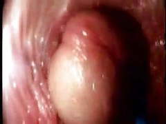 Close-up Videos